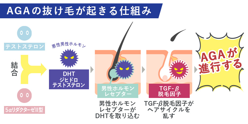 薄毛が起こるメカニズムの図説