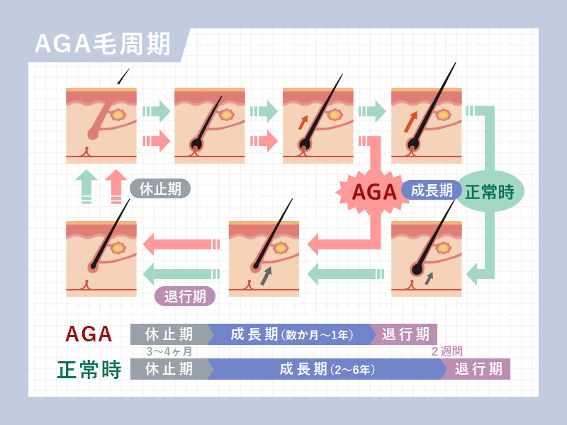 AGA毛周期の図説