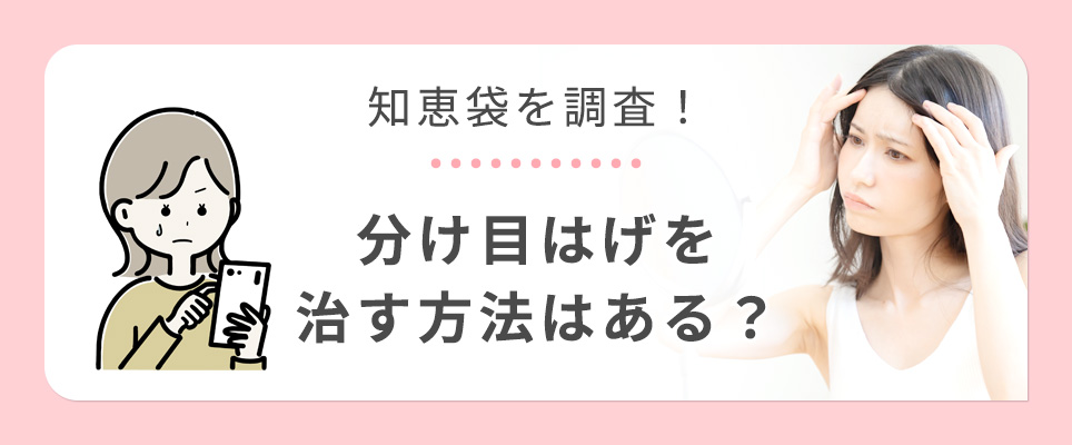 分け目はげを治す方法を知恵袋で調査
