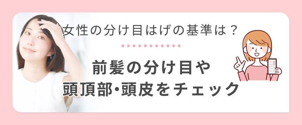 女性の分け目はげの基準をチェック