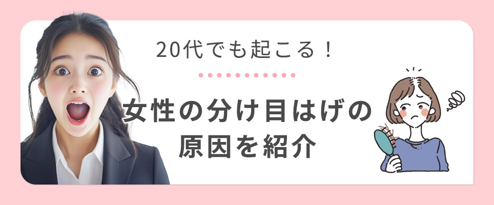 20代でも起こる女性の分け目はげの原因