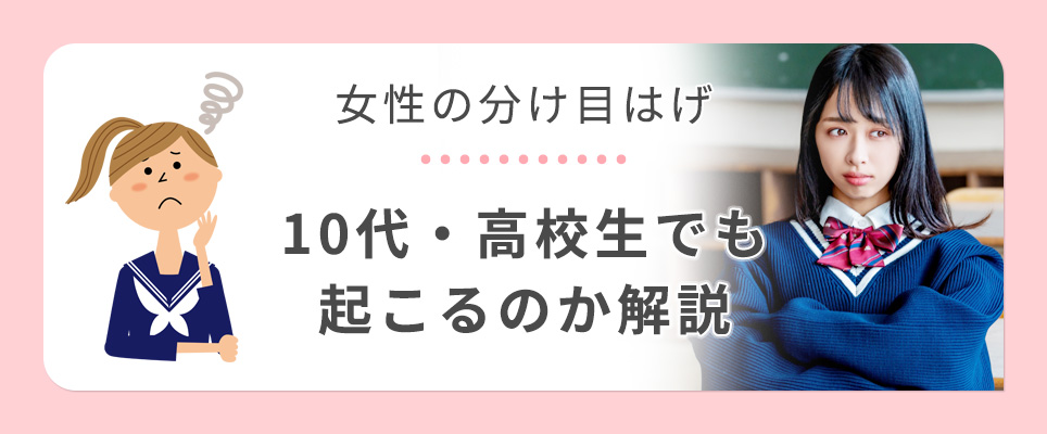10代でも分け目はげが起こるのか