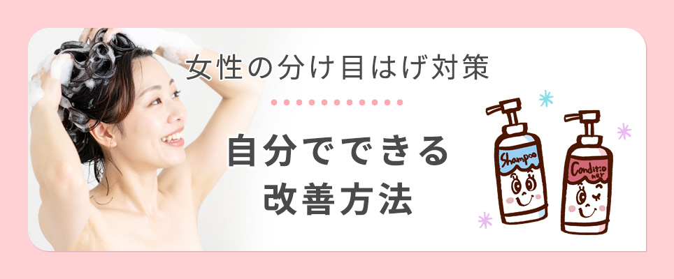 女性の分け目はげの対策と改善方法