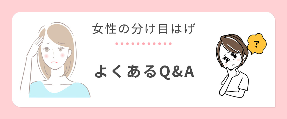 女性の分け目Q&A