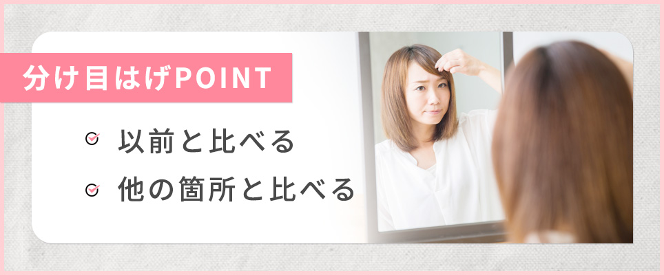 女性の分け目はげの基準の重要ポイントまとめ
