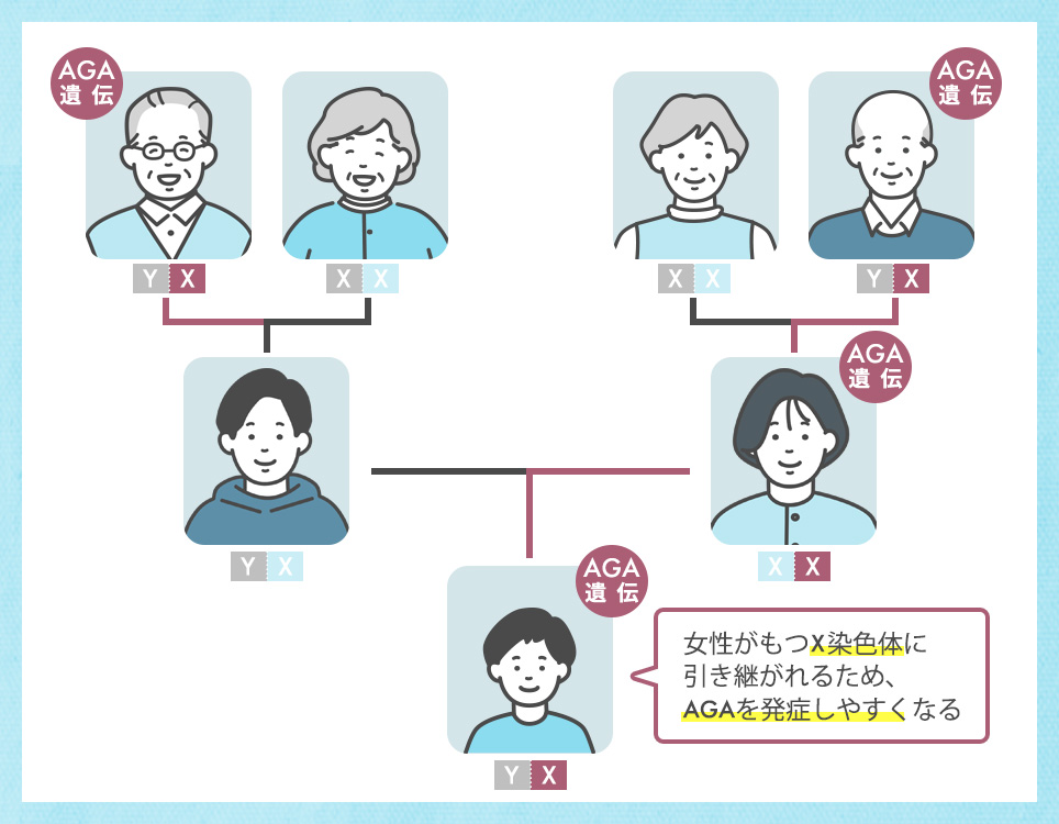 AGA遺伝の家系図