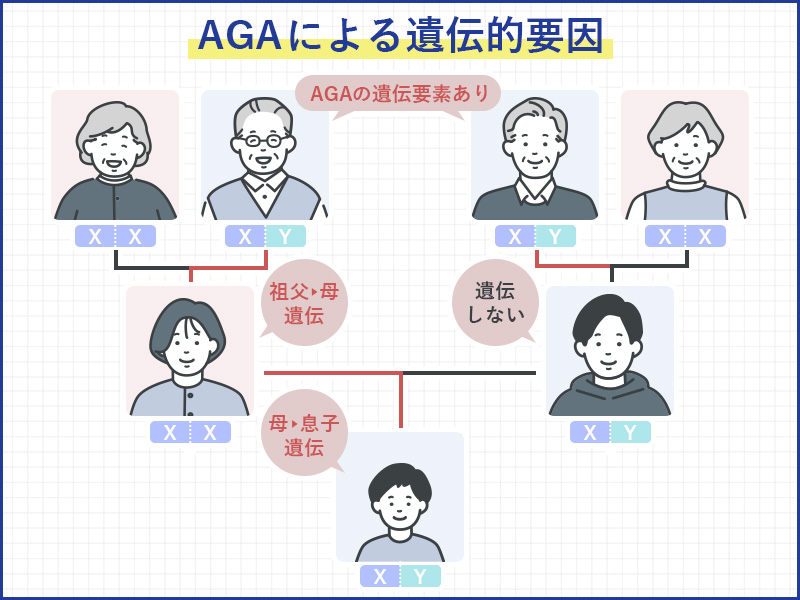 AGAによる遺伝子的要因を説明した家系図のイラスト
